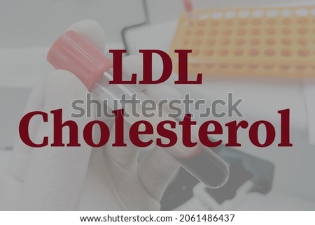 LDL cholesterol test with laboratory background, Low density lipoprotein