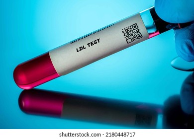 Ldl Test Blood Tests For Older Adults. Recommended Blood Test For The Elderly