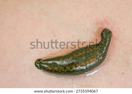 Leech worm attaching to human leg skin during an alternative medicine hirudotherapy procedure, used for specific medical treatment by sucking blood and releasing beneficial enzymes