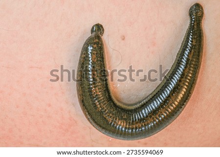 Leech worm attaching to human leg skin during an alternative medicine hirudotherapy procedure, used for specific medical treatment by sucking blood and releasing beneficial enzymes