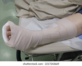 The Left Foot Injured In An Ankle Sprain Accident Had To Be Cast In A Soft Splint And Elastic Bandaged From Foot To Calf On A Bed In A Hospital Emergency Room