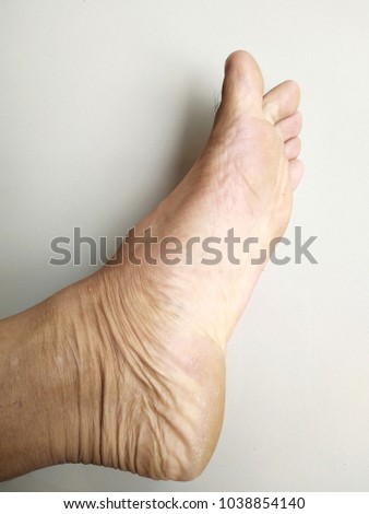 The left foot of the man on the side, taken close-up on a dim white background in the back.