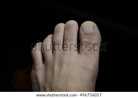 Left foot on a dark colored background.