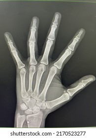 Left hand and bone structure - Shutterstock ID 2170523277