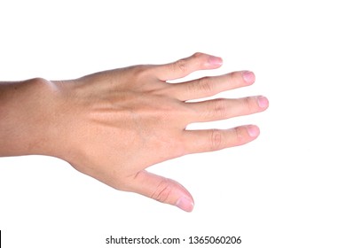 Deformed Hands Images, Stock Photos & Vectors | Shutterstock