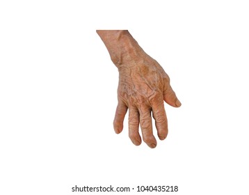 Left Hand Of Old Man And Or Women Is Gout