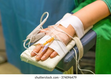 Left Hand Of Patients In Fat Grafting Operation Room