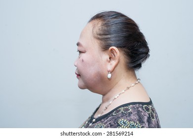 The Left Hand Side View Of A Middle Aged Asian Woman Hair Braid