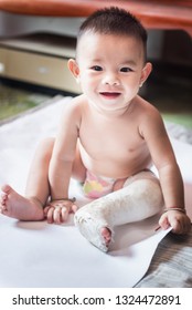 Left Leg Of Asian Baby Litlle Child In Splint, Sit Down On Bed.