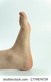 The Left Leg Of A Man With Signs Of Joint Disease And Flat Feet (pes Planus Or Fallen Arches)