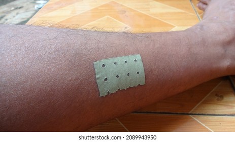 The Left Leg Of Someone Who Is Sick Is Put On A Patch