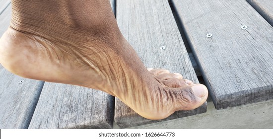 A Left Male Foot Plantar Flexion On A Planked Wooden Outdoor Walkway.