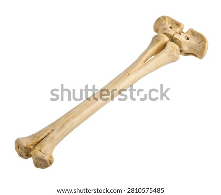 Left Radius Left Radius Displayed In Three Qua Isolated On White Background