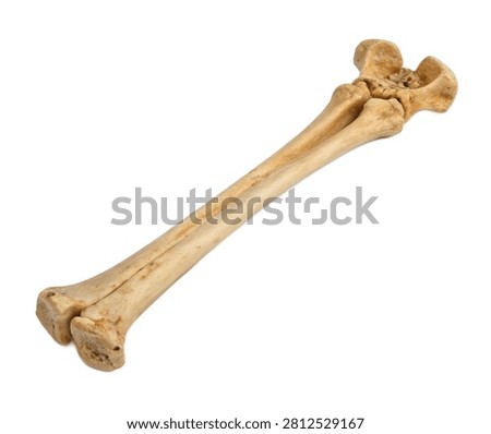 Left Radius Left Radius Displayed In Three Qua Isolated On White Background