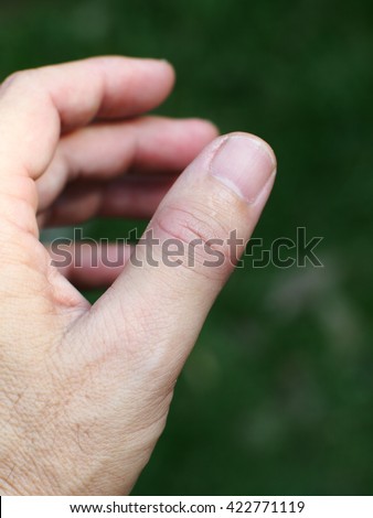 left thumb pain Left thumb pain