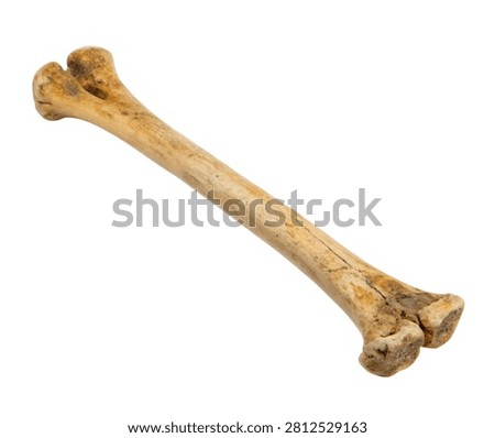 Left Ulna Left Ulna Shown In Front Perspective Isolated On White Background