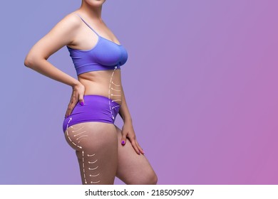 Leg, buttocks, abdomen liposuction, fat and cellulite removal concept, overweight female body with painted surgical lines and arrows on a purple background with a gradient - Shutterstock ID 2185095097