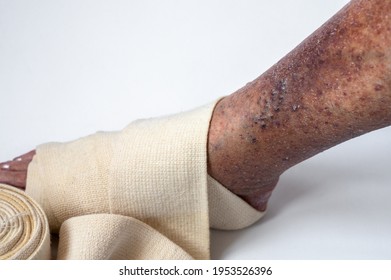 bandage dupa operaie varicoza