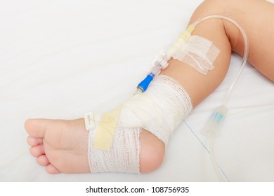 Leg Of Injured Baby With Bandage And Medical Equipments