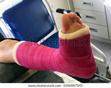 Leg in a pink plaster cast.