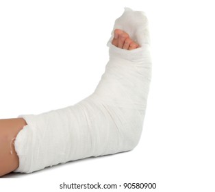 Leg In A Plaster Cast On A White Background