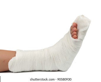 Leg In A Plaster Cast On A White Background