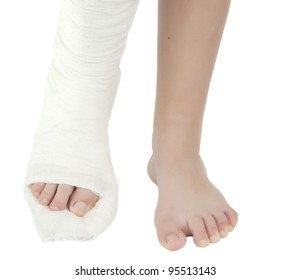 Leg In A Plaster Cast On A White Background