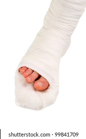 Leg In A Plaster Cast On A White Background