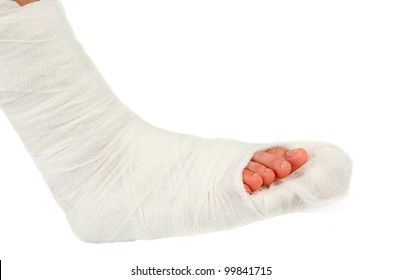 Leg In A Plaster Cast On A White Background