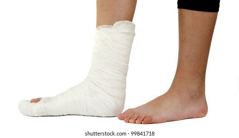 Leg In A Plaster Cast On A White Background