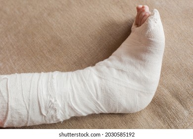 Leg In Plaster Of A Teenage Girl On A Sofa After An Accidental Fall With An Ankle Fracture