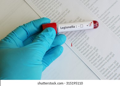 Legionella Positive