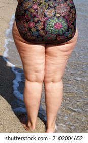 Legs Of A Curvy Woman With Cellulite In A Swimsuit, Back View Close-up