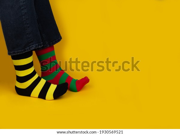Legs with different stripes socks on background\
with copy space. World Down syndrome day background. Down syndrome\
awareness concept.
