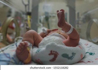 Legs And Feet Of Premature Baby In NICU 