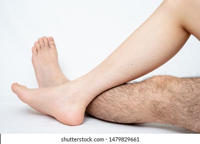 Legs Hair Removal For Men, Before & After. Applies To One Leg Only.