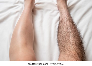 Legs Hair Removal For Men, Before And After Image. 