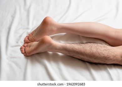 Legs Hair Removal For Men, Before And After Image. 