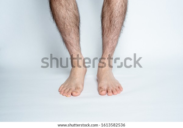 Legs hair removal for men,\
before.