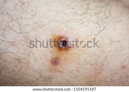 Similar – umbilicus Fluff Navel