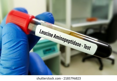 Leucine Aminopeptidase (LAPs) Test Measures How Much Of This Enzyme Is In Blood To Diagnose Liver Disease.