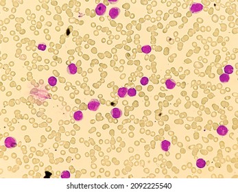 Hematopoiesis Images Stock Photos Vectors Shutterstock