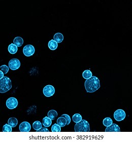 Leukemia Cells Labeled With Fluorescent Molecules