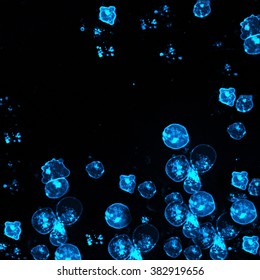 Leukemia Cells Labeled With Fluorescent Molecules