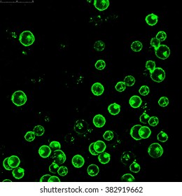 Leukemia Cells Labeled With Fluorescent Molecules