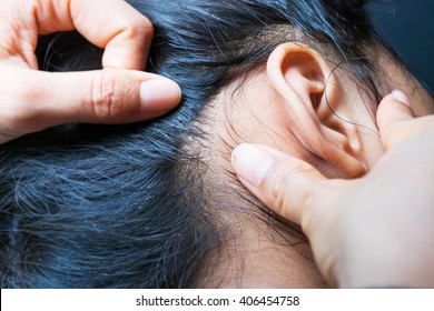 Lice On Human Hair