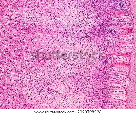 Light micrograph of the adrenal cortex showing, from right to left, the zona glomerulosa, the wide zona fasciculata, and the zona reticularis in which the sinusoidal capillaries are more dilated.