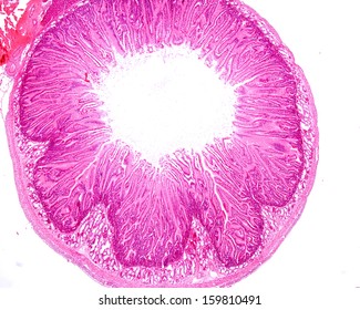 Light Micrograph Of A Cross Section Of The Wall Of The Small Intestine (duodenum) Showing Villi And Brunner's Glands In The Submucosa.