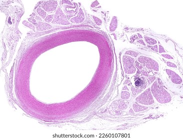 Light micrograph of a cross-sectioned elastic artery. Almost the entire wall corresponds to the tunica media.Around the artery, there are brown adipose tissue lobules. Hematoxylin-eosin