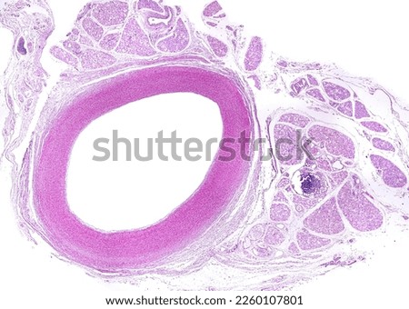 Light micrograph of a cross-sectioned elastic artery. Almost the entire wall corresponds to the tunica media.Around the artery, there are brown adipose tissue lobules. Hematoxylin-eosin
